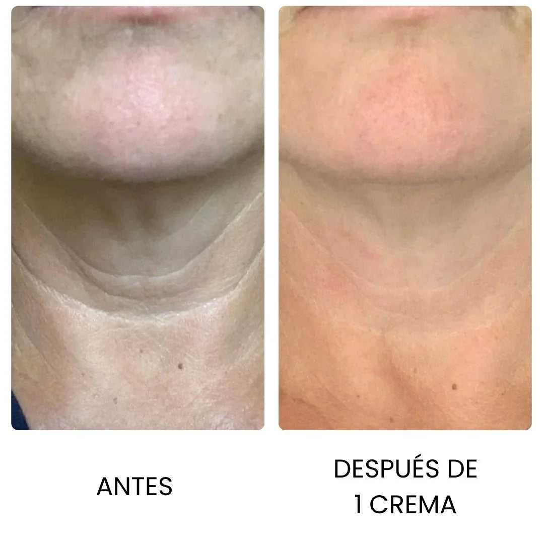 GOPURE™ 2X1 ✨ Crema Reafirmante Lifting Para El Cuello