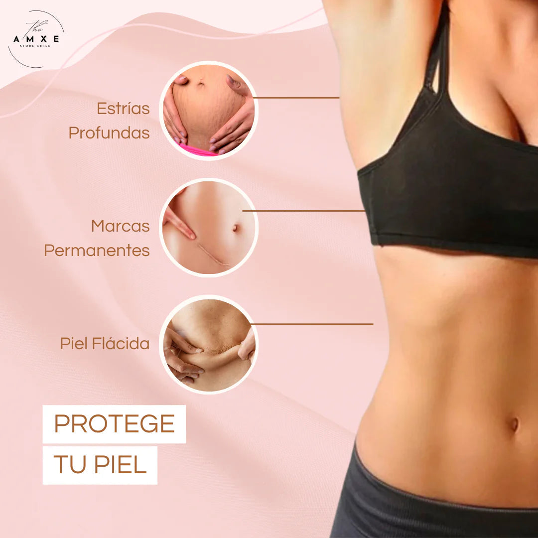 SkinRepair® 2X1 ✨ Crema Antiestrías y Anticelulitis