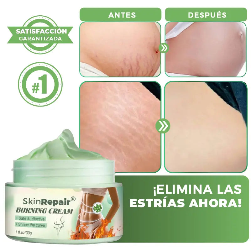 SkinRepair® 2X1 ✨ Crema Antiestrías y Anticelulitis