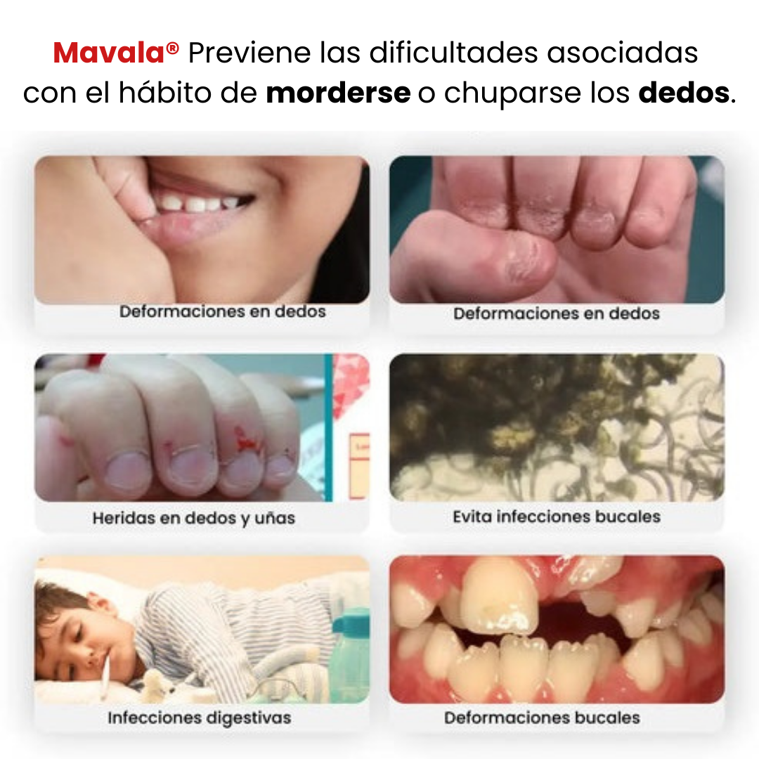 Tratamiento para evitar comerse las uñas 100% Natural🍃