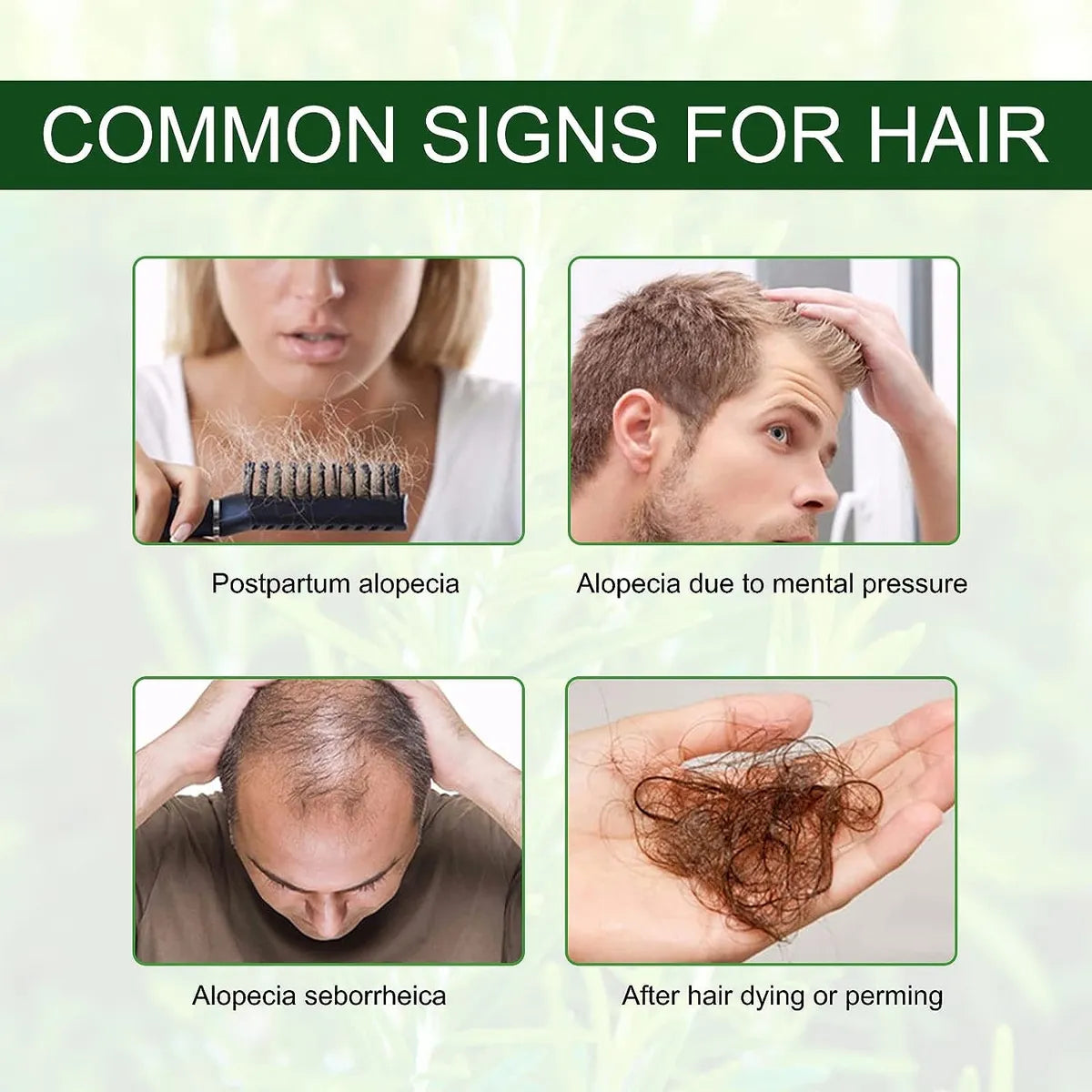 Aceite Esencial De Romero Para El Crecimiento Del Cabello 2x1 ✨